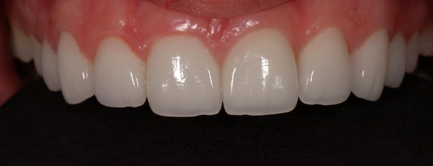 Images Pacific Dental Care