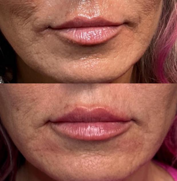 Images Ageless Med Spa