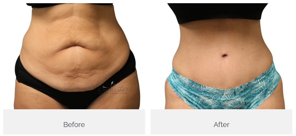 Castellano Cosmetic Surgery Center Image