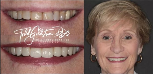 Images Todd Goldstein DDS