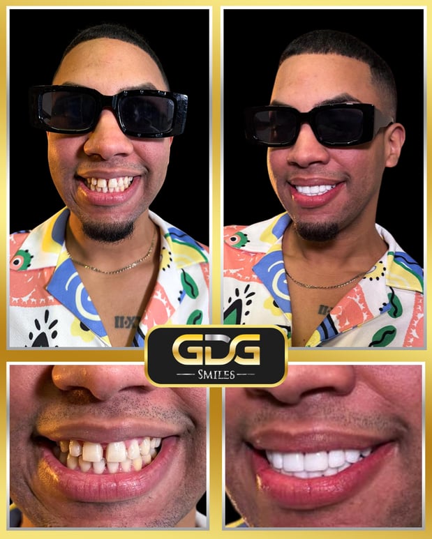 Images GDG Smiles