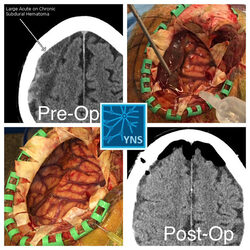 Yashar Neurosurgery Photo