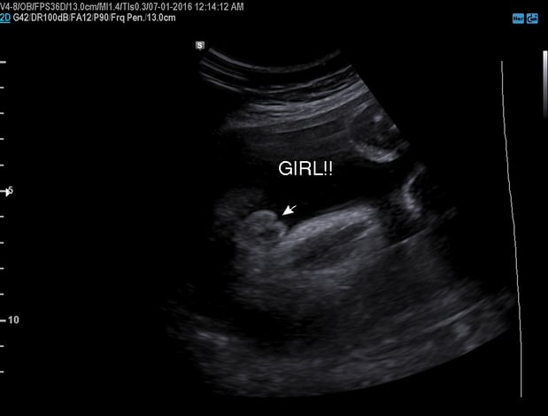 Images Heavenly 3D 4D Ultrasounds