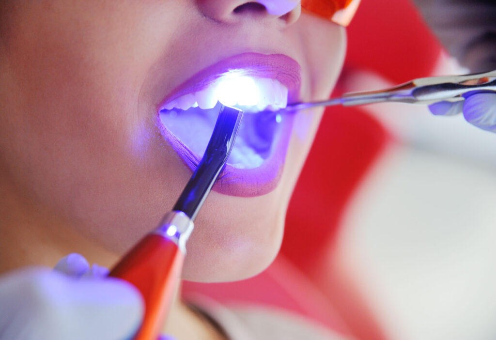 Zahnerhaltung - Zahnarztpraxis Stefan von Ostranitza |  Zahnarzt Zahnersatz Parodontologie | München
