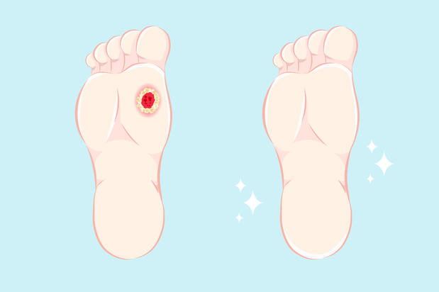 Images A Call Away Footcare