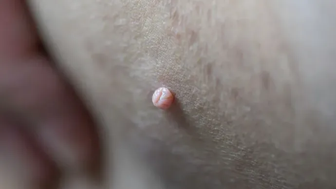 Images Dr. Juan José Salazar