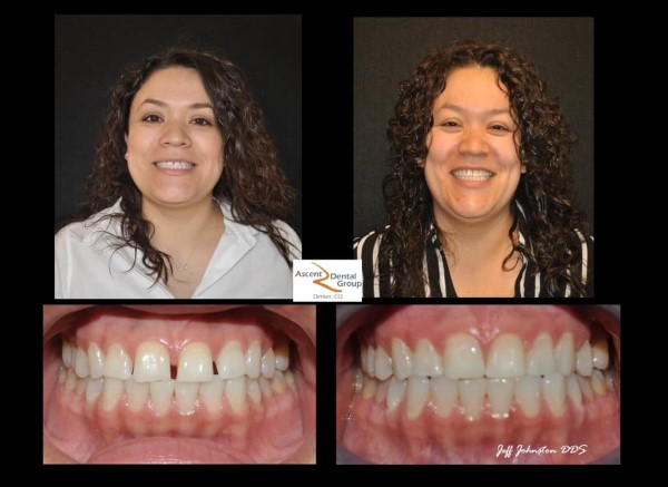 Images Ascent Dental
