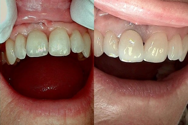 Images Haws Family Dentistry