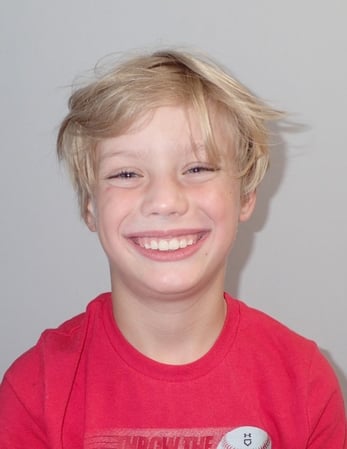 Images Imagine Orthodontics