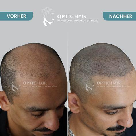 Haarpigmentierung Köln | OpticHair, Höninger Weg 176 in Köln