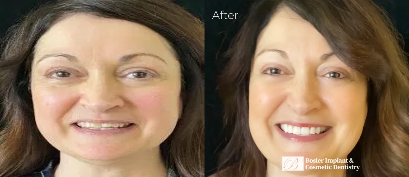 Bosler Implant & Cosmetic Dentistry Image