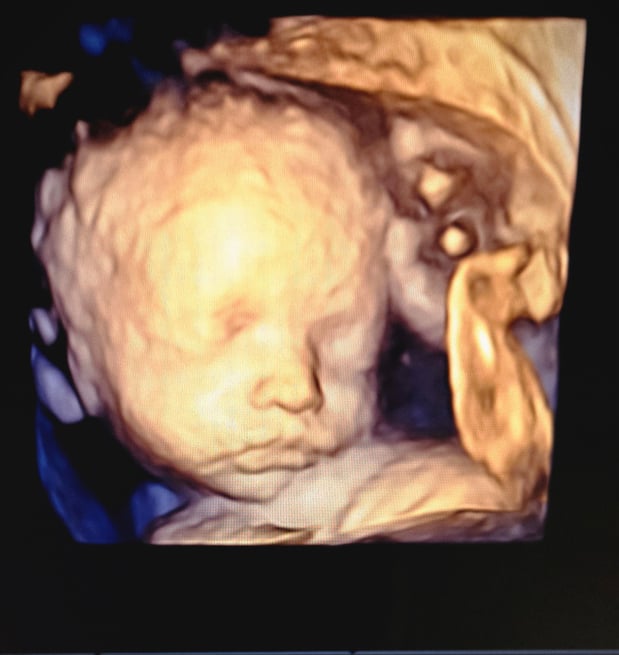 Images Love At First Sight 3D/4D Ultrasound Imaging Studio, LLC