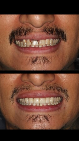 Images Sunbrite Dental