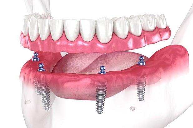 Images Smooth Dental and Orthodontics