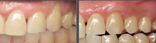 Images Embarcadero Dentistry