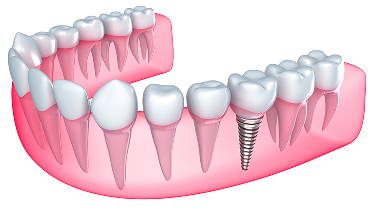 Images Tandlægerne i Sportsbyen