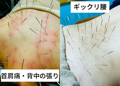 Images 鍼処KAKUREGA