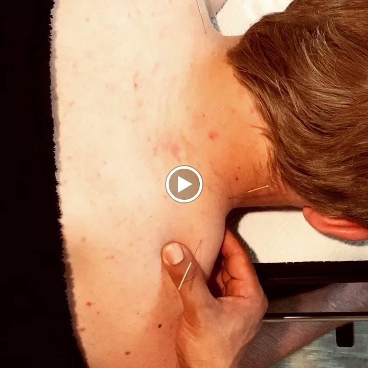 Images Alex Mendieta Chiropractic