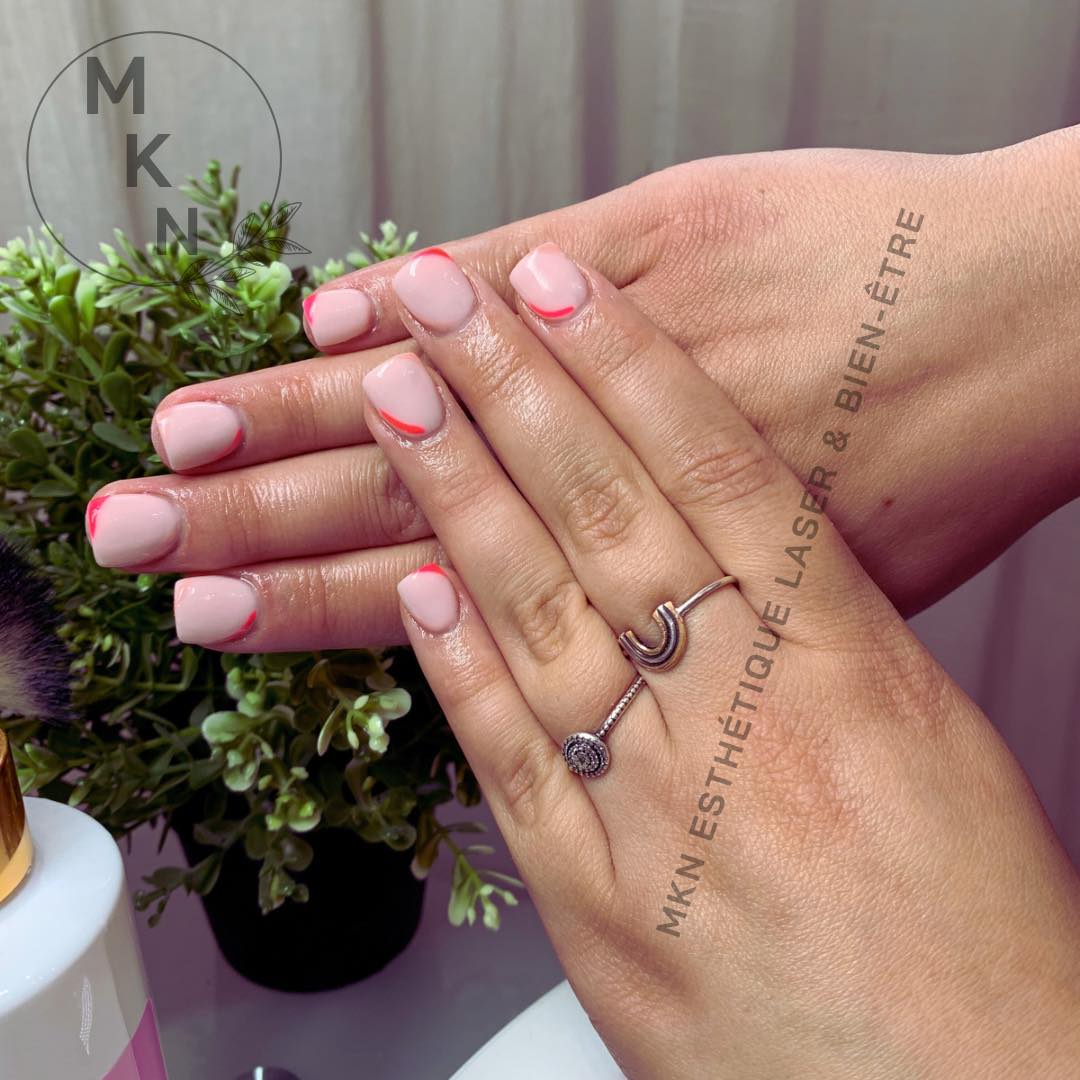 Images MKN Esthétique Laser & Bien-être