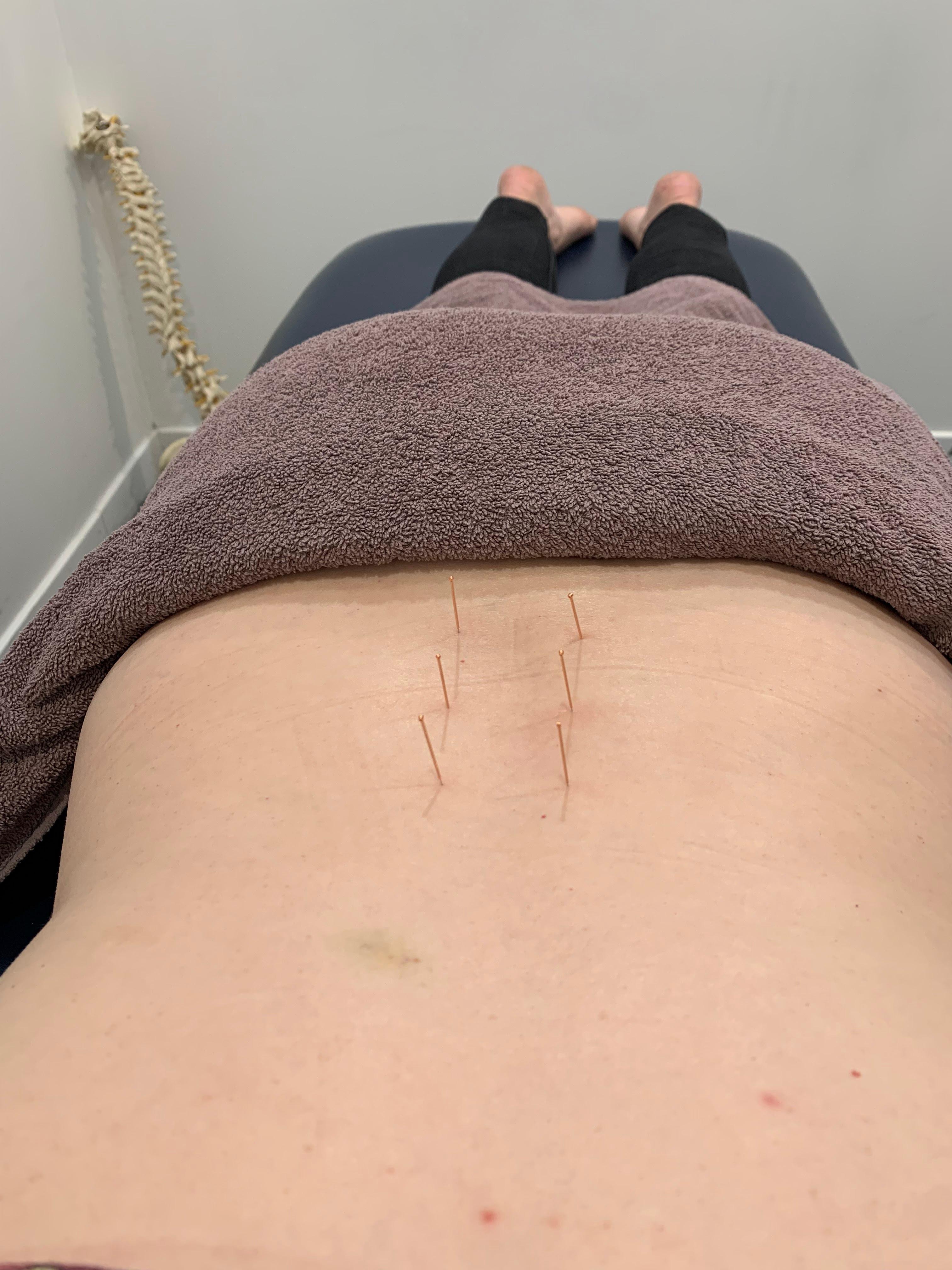 Images Alex Mendieta Chiropractic