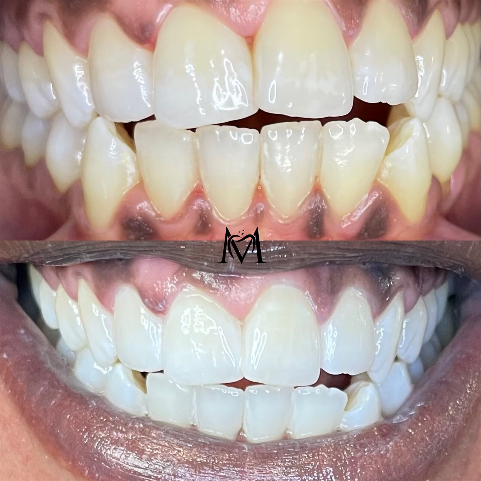 M&M Dental Beauty, Eichendorffstraße 70 in Pfullingen