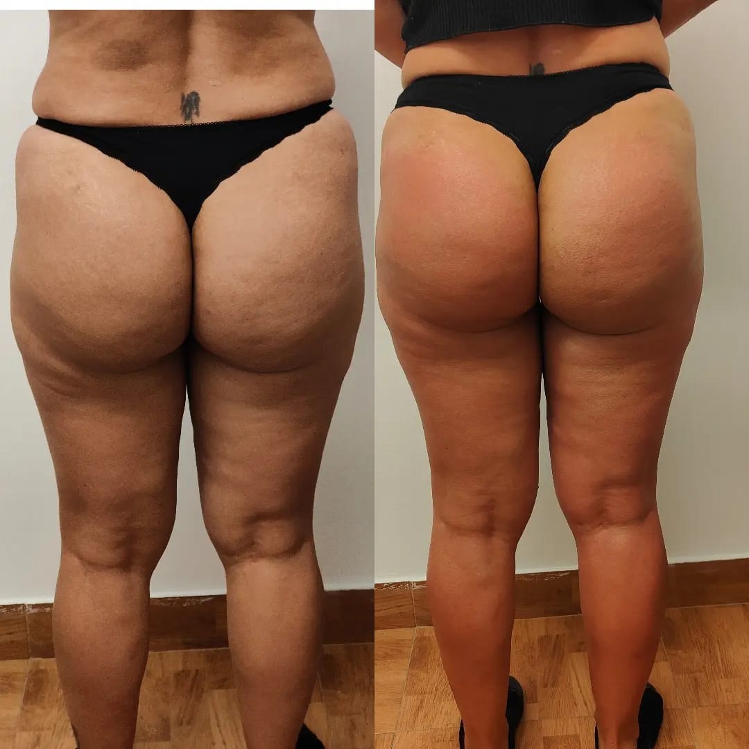 Images Miranda Belleza y bienestar Valencia