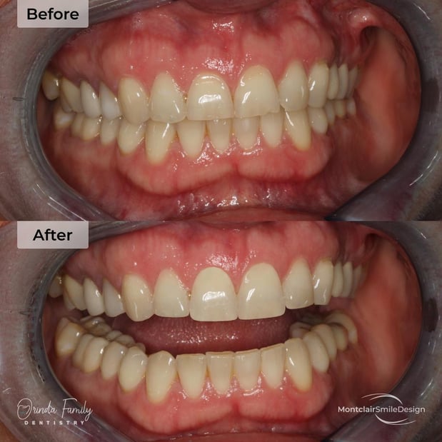 Images Orinda Family Dentistry