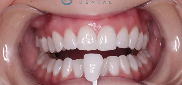 Images Enrich Dental