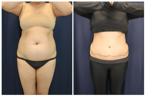 Images Columbia Aesthetic Plastic Surgery