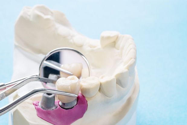 Images Elrod & Dunham Dentistry