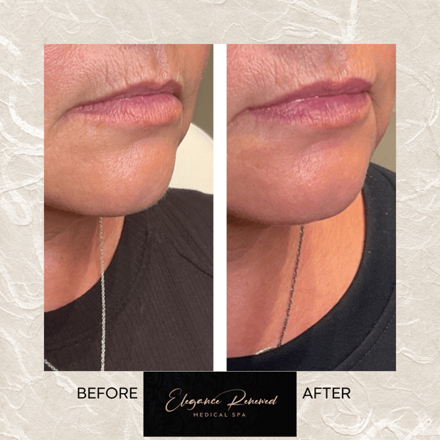 Images Elegance Renewed Medical Spa