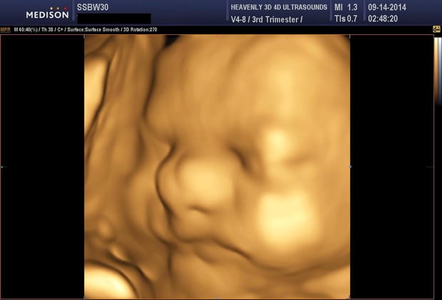 Images Heavenly 3D 4D Ultrasounds-Upland