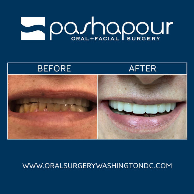 Images Pashapour Oral + Facial Surgery