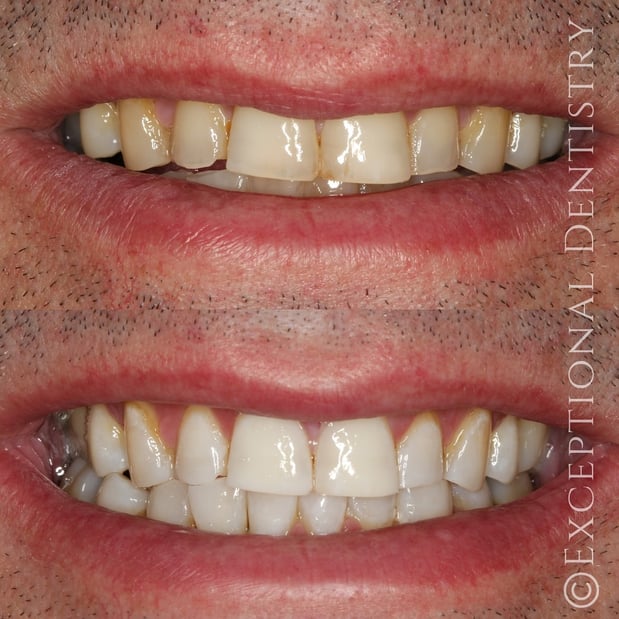 Images Exceptional Dentistry of the Tri-State Region