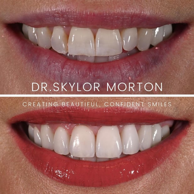 Images Nashville Wisdom Teeth and Implant Solutions
