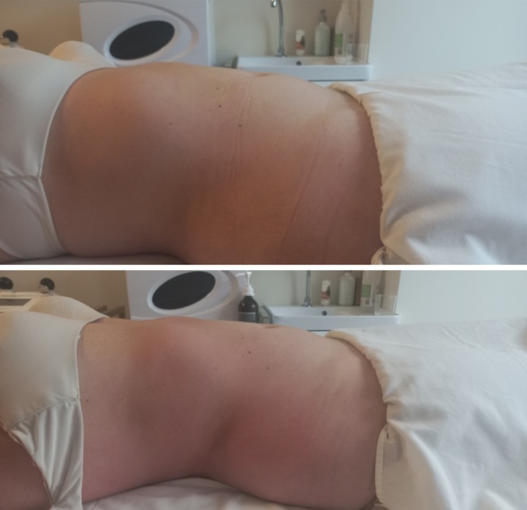 Images VitalmassageSevilla