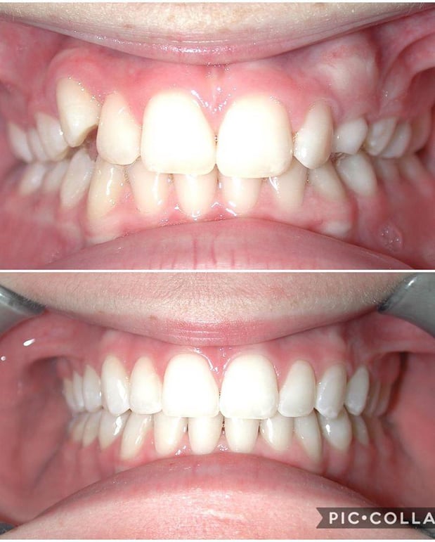 Images Elison Orthodontics South Jordan: Timothy B Elison