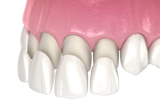Images Mt. Pleasant Modern Dentistry