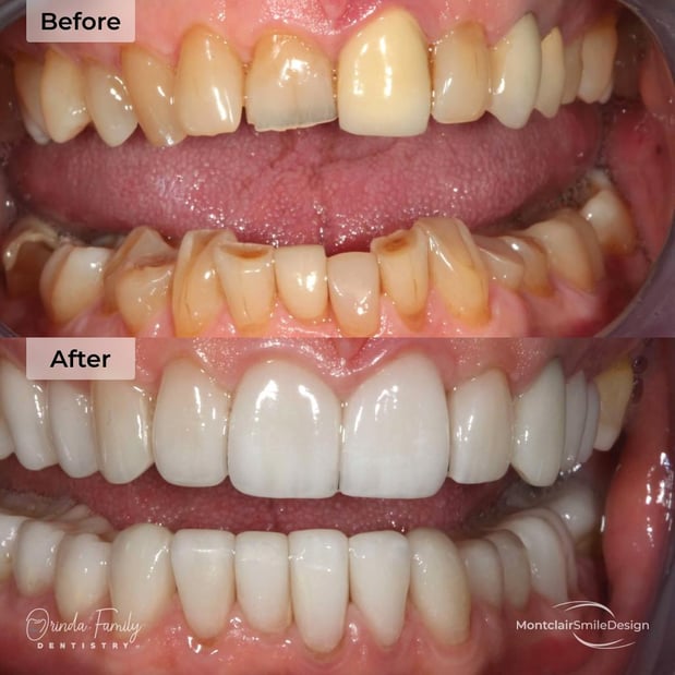 Images Orinda Family Dentistry