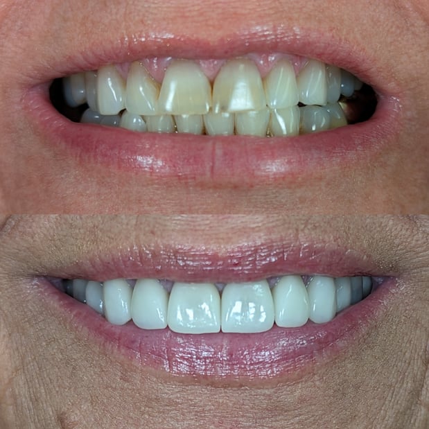 Images South Weber Dental