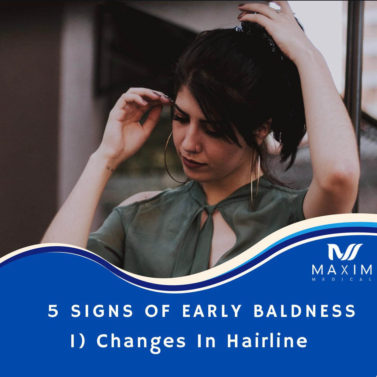 5 Early Signs Of Baldness

1. Changes In Hairline
One of the main early signs of incoming baldness is a change in your hairline. Though it is not a 100% guarantee for baldness, it is still a common sign of it. For the most part, the change in their hairline for men is seen in the receding frontal hairline, specifically the corners. The result of this corner recession usually ends up being what is known as a widow’s peak.