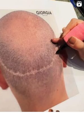 Images Giorgia Hair Clinic