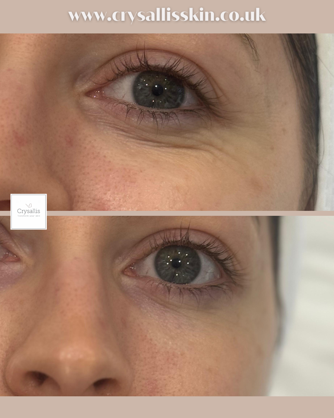 Images Crysallis Skin Clinic