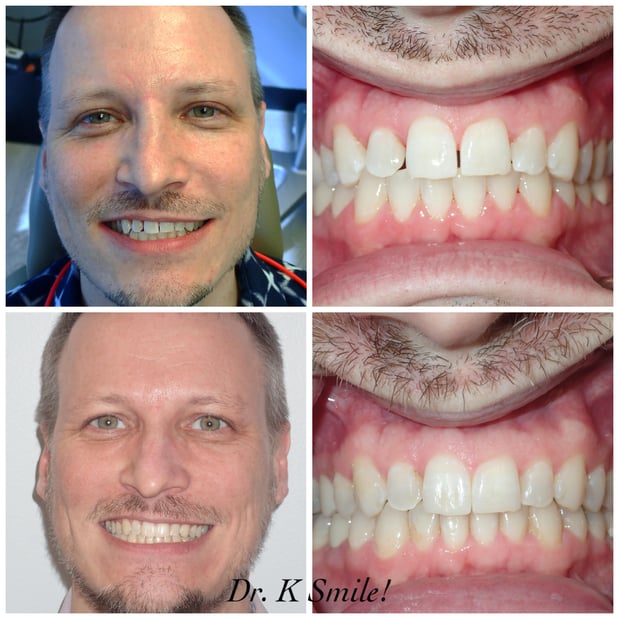 Images Reston Heights Dental