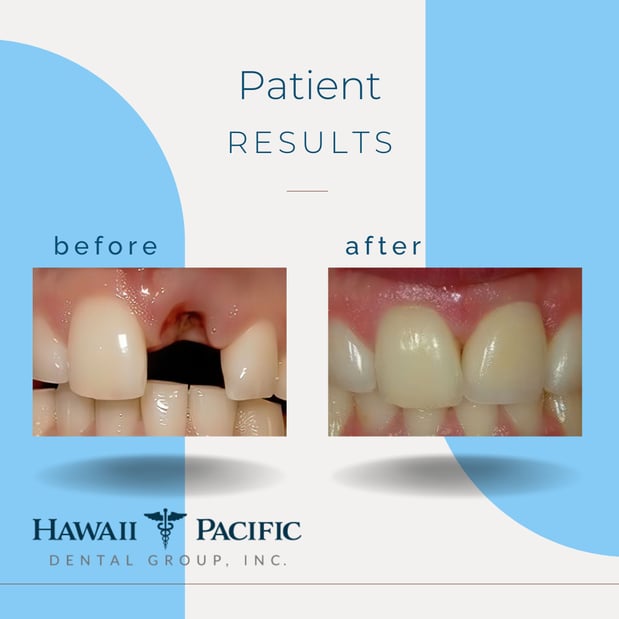 Images Hawaii Pacific Dental Group, Inc.