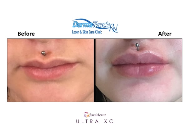 Images DermaTouch RN