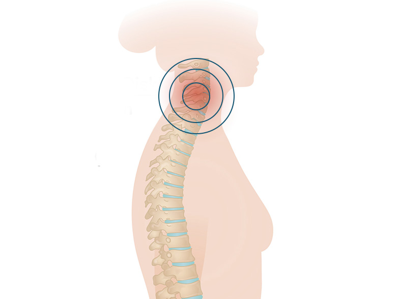 Cncrns_Cndtns-backpain-neck392x294_@2x.jpg