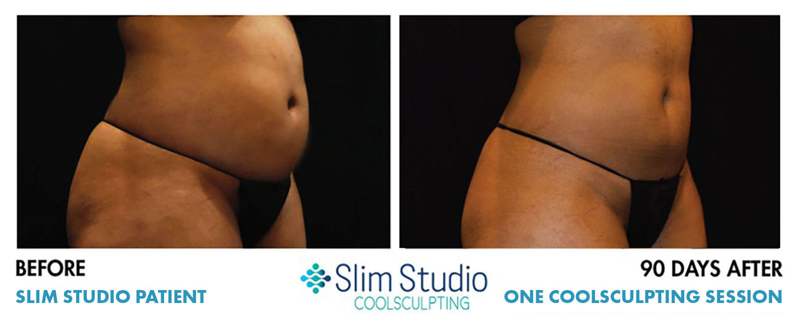 Slim Studio EMSCULPT & Coolsculpting Photo