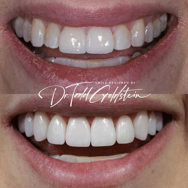 Images The Smile Aesthetic