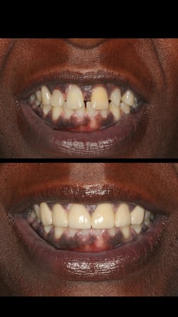 Images Sunbrite Dental